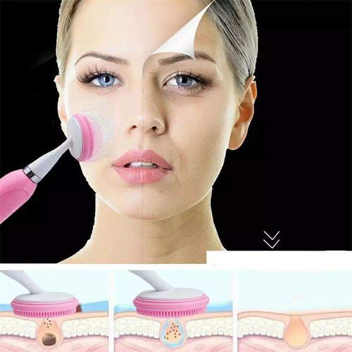 هوميروي - مقياس جمال الاهتزاز الصوتي